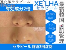 サロン イニ(SALON INI)の雰囲気（韓国No.1肌育ピーリングを山形で◎ダウンタイムなしで白玉ツヤ肌）