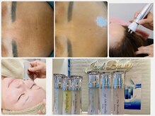 ジュエルビューティー(Jewel Beauty)