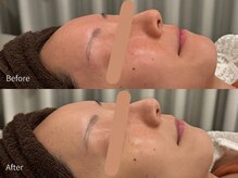 アウラ 小杉店(AULA)/ララピール☆