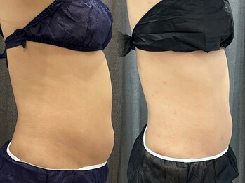 アエ メゾン(ae maison)/厚みがこんなに違う!