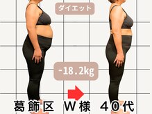 楽陽堂鍼灸院/葛飾区 W様40代　痩身プログラム