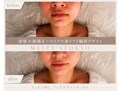 メルティーズ 東京 麻布十番(MELTY's)の写真