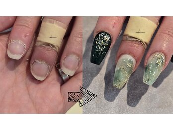 シーナ(Siina)の写真/爪の形のコンプレックス改善。深爪や丸爪から、長さを出すことも可能。