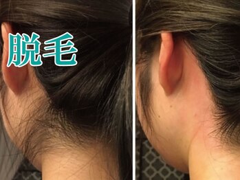 美宝 元町/うなじ