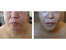 りた/脂肪と筋肉へアプローチ！！