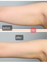 ビハダ(BeHADA)/#ダイエット/脂肪分解/引締