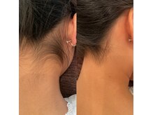 ルッカヘアガーデンバイラッシュゴールド(RUCCA HAIR GARDEN by LUSH GOLD)の雰囲気（うなじ脱毛★痛みが苦手、敏感肌の方OK！ツルスベ肌へ導きます♪）