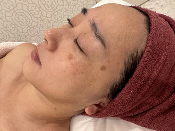 ナンバー19(N°19)の写真/年齢とともに出てきたシミ・しわにお悩みの方へ。美しい素肌を手に入れるための特別なケアを体験ください♪