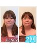 エステ付き小顔矯正60分◆ヘッド・顔・デコルテ肩まわりリンパ¥12000