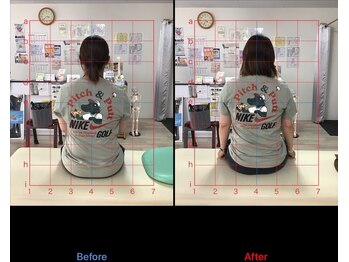 ストレチックス 近江八幡店/BeforeAfter