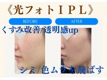 ムーンライズ(moonrise)/