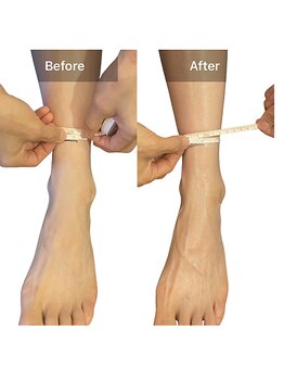 ベンザイ 新潟店(BENZAI)/足首がマイナス1、2センチ