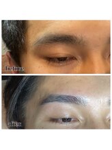 ピュール 鯖江店(PUR)/メンズ/眉毛/メンズ脱毛/脱毛