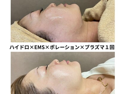 ニコノ(Nicono)の写真