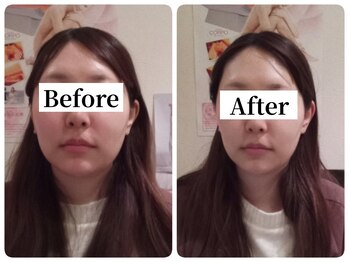 マンマ ジュンナ/【浜松/小顔/小顔矯正】