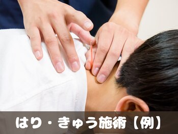 穴川駅前整骨院鍼灸院/はり・きゅう施術【例】