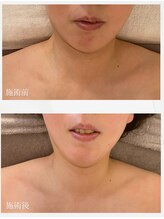 ピーロ ルレ(salon Piilo Rule)/首でフェイスラインが変わる