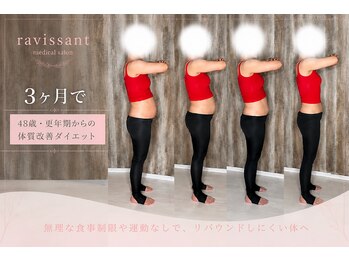 ラヴィソン(ravissant)の写真/何をしても痩せなかった方へ☆3ヶ月で8キロ減！体重だけじゃない！自信まで変わる3ヶ月◎