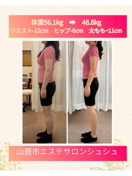 シュシュの写真/【40代からの本気のダイエット】自己流ダイエット卒業！３ヶ月で理想の私へ♪
