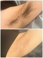 ワクシー 麻布十番店(WAXYYY.TOKYO) メンズも脱毛メニューご案内可能です◎