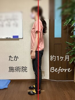 たか施術院/腰痛 関節の痛 めまい 初～1ヶ月