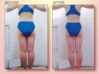 ジュリア オージェ 京橋店/ビフォーアフター(美脚コース)