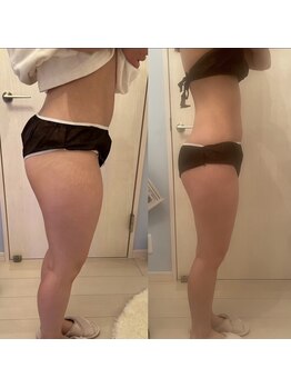 メゾン アンジュ(Maison Ange)/脚2回目/マイナス6kg