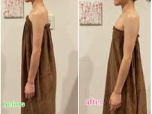 ロココ 大宮店(Rococo)/巻き肩姿勢改善