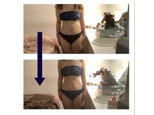 アクア エステティコ 亀有(ACQUA estetico)/脂肪燃焼6回