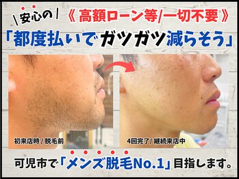 毛抜き屋 可児店/◇高額ローン不要・都度払い可◇