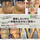 シェーングランツ(SchonGlanz)