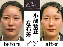 クレスト(CREST)の雰囲気（30代女性→スマホ首と顎下のたるみでお悩みの事務員の女性）