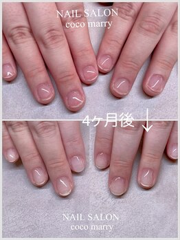 ネイルサロン ココマリー(coco marry)の写真/深爪・二枚爪・巻き爪などのお悩みもお任せ♪フィルインと丁寧なネイルケアで、自信の持てる美しい指先へ。