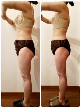 シエスタ(SIESTA)/Before→After お尻も上がります