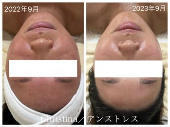 ルルボーテ(Loulou Beaute)/クリスティーナ/アンストレス