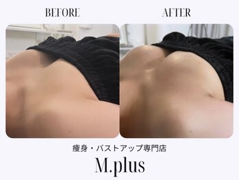 エムプリュ 心斎橋店(M.plus)/バストアップコース1回