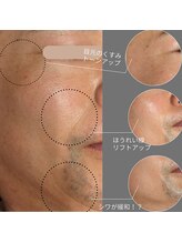 トリニティスペース(TrinitySpace)/ハーブ×プラズマ