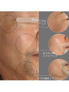 トリニティスペース(TrinitySpace)/ハーブ×プラズマ