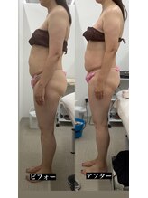 メリアミーゴ(Meli amigo)/50代女性　猫背改善×お腹