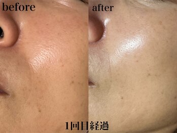 フェイシャルサロン アリイ(ALII)/