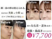 ラプリ 大宮店(Raplit)
