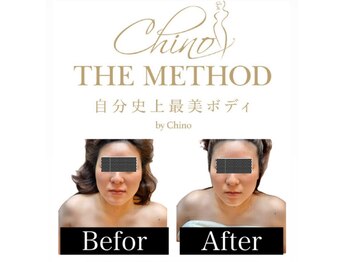 アンベリール(Embellir)/フェイスメソッドで幼顔へ♪