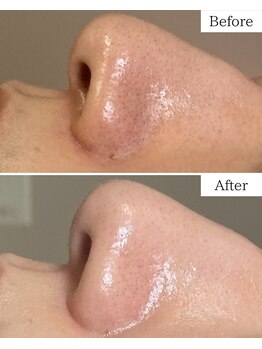 シャムリー(SHAMRY)/TROIAREUKE／スキンメイド