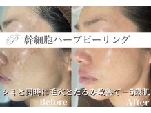 パールホワイトニングサロン 大和店の雰囲気(長年のお悩みのシミを改善大きい~小さいシミも改善/大和エステ)