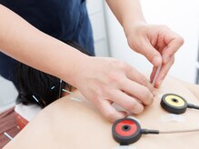 ビーウェイブ鍼灸院(BE-WAVE鍼灸院)