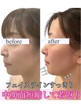アールズ スリム(R's slim)/フェイシャルも結果重視の専門店