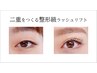 話題のアイストレッチのみ◎むくみ、クマ、目の疲労改善ぱっちり目に☆