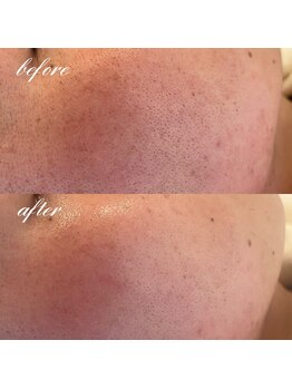 シーズボーテ(C's Beaute)/メンズもキレイの更新中です！！