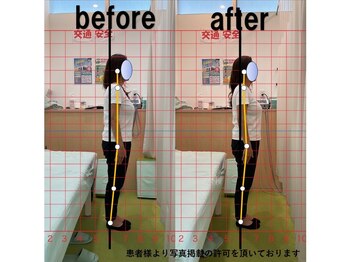 よし鍼灸接骨院 東花園院/施術効果【整体/骨盤矯正/大阪】