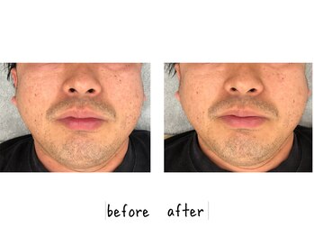 シフク鍼灸整体院/30代(加工なし)